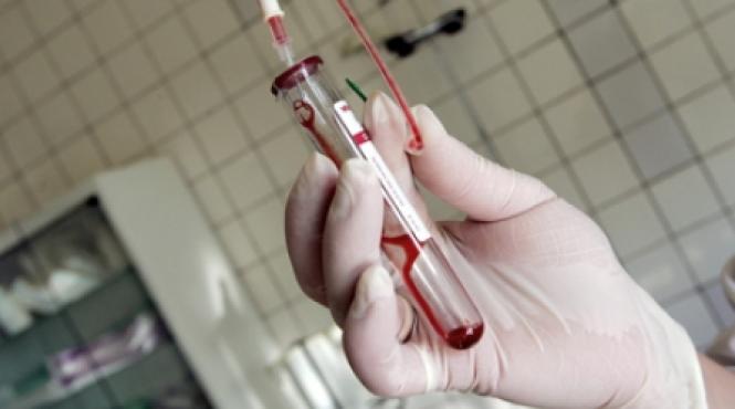 vaccinul anti sida este realizabil