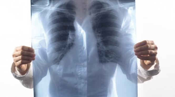 necazuri si iar necazuri in plamani