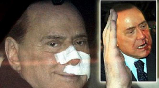 un filmulet postat pe you tube sugereaza ca berlusconi si a inscenat atacul