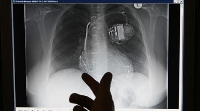 stimulator cardiac performant