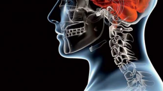 neirigarea creierului