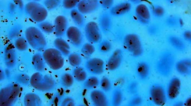 celule cu final asteptat