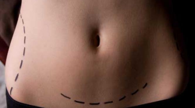 coapse si abdomen la bisturiu