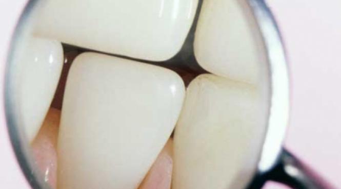 dinte pe dinte se vindeca