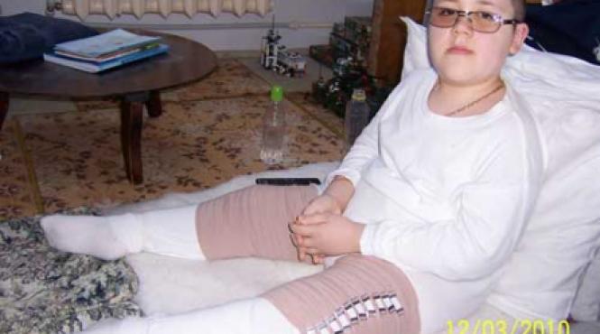 copilul cu oase de sticla