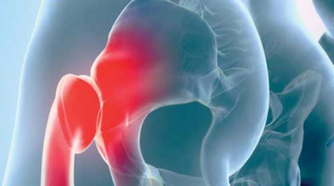 osteoporoza rupe vertebrele