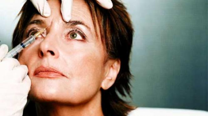 fara riduri cu botox