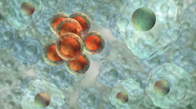 cancerul alarmeaza oms