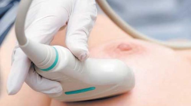 stilul de viata si cancerul la san