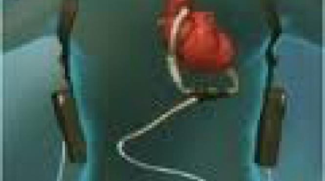 prima inima artificiala permanenta implantata unui adolescent