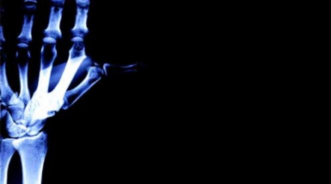 boala incheieturilor