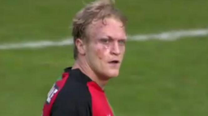 a ramas cu urma crampoanelor pe fata dupa ce a fost calcat de un adversar