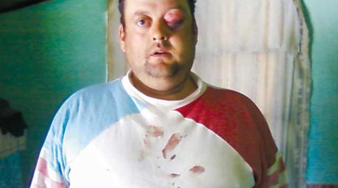 padurar cu proptele in pdl