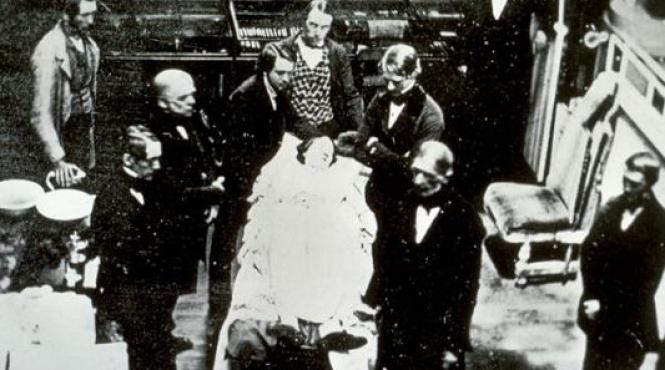 cancerul la inceputuri fotografii din secolul xix