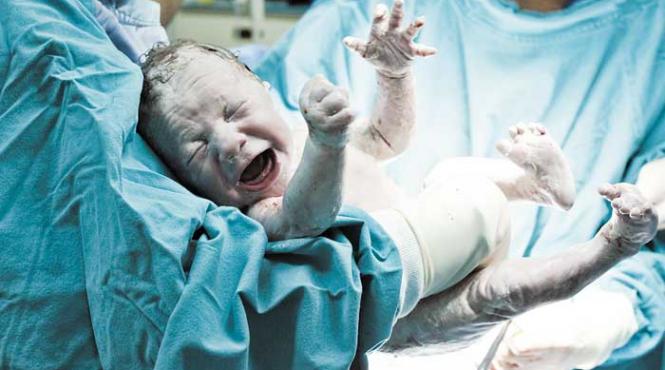 cum se prezinta fatul la ceremonia nasterii