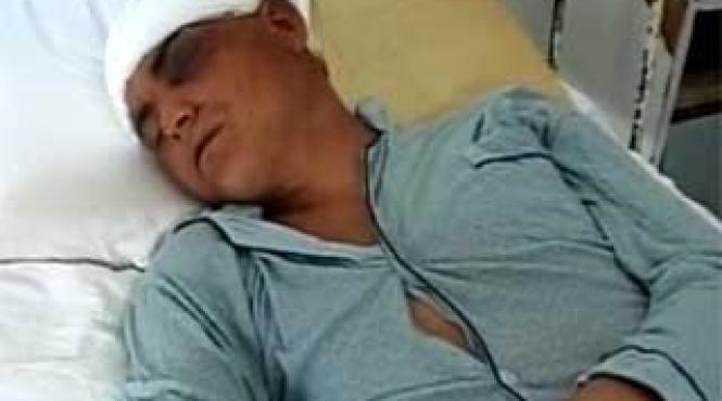 varul lui bute in coma la spital dupa ce a fost batut in fata discotecii din pechea pentru ca a refuzat sa dea o tigara