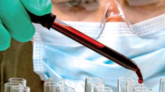 aflati daca ficatul e bolnav