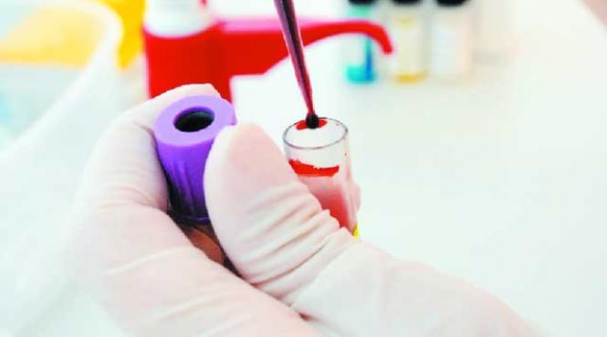 afectiunile glandei suprarenale