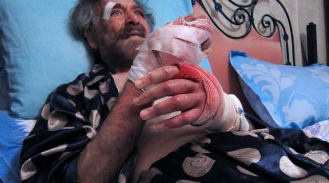 sustinatorii presedintelui sirian i au rupt mainile caricaturistului politic ali ferzat