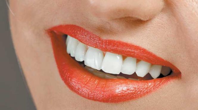 proteza scheletata alternativa la implanturile dentare