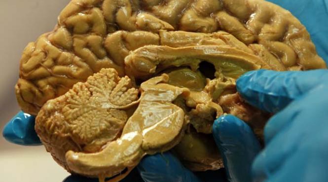 veste grozava pentru diabetici boala poate fi vindecata cu ajutorul celulelor stem ce se extrag de la pacient