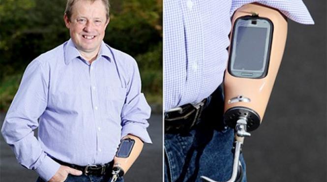 omul cu telefon mobil in proteza care ii tine loc de mana