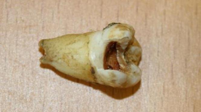 un dinte cariat al lui john lennon vandut la licitatie vezi cu ce suma impresionanta a fost cumparat