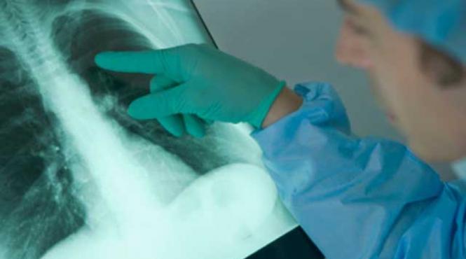 avertisment scuipatul pe strada poate raspandi tuberculoza