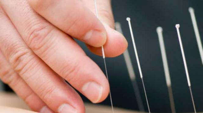terapia cu ace si curent electric calmeaza durerile electroacupunctura este ideala in sezonul rece