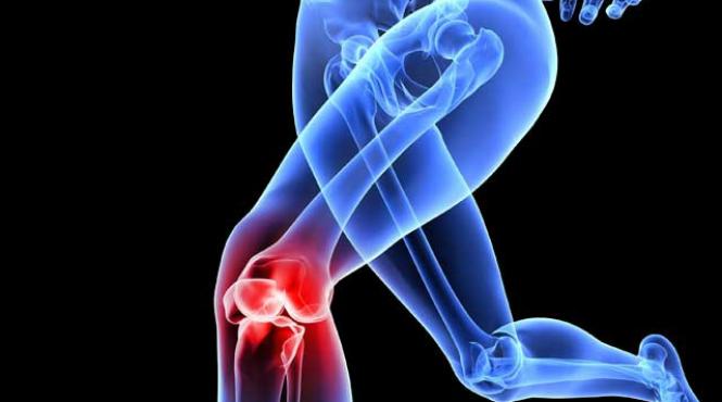 balamuc in genunchi cand artrozele au facut harcea parcea articulatia este necesara proteza