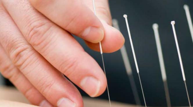 acupunctura si fertilizarea in vitro