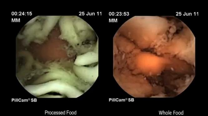 ce se intampla in stomacul nostru cand mancam preparate si semi preparate video