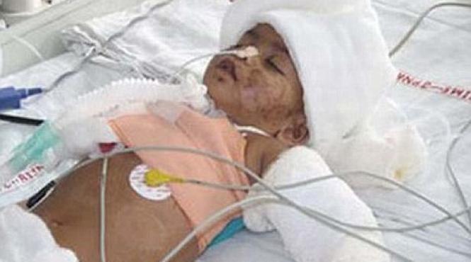 soc in india un copil a fost spitalizat cu urme de muscaturi de om
