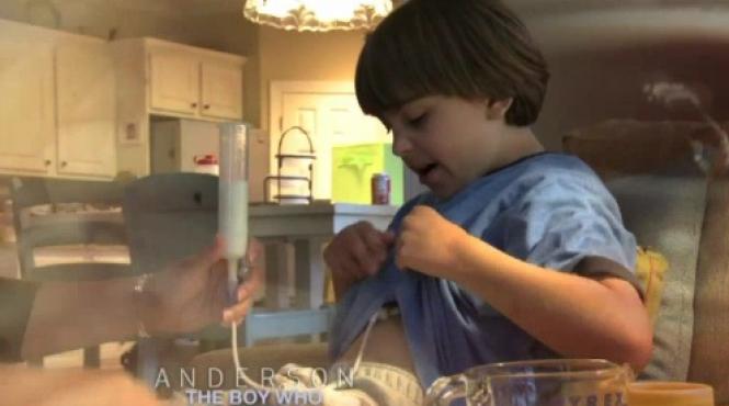 baietelul de 9 ani alergic la mancare video