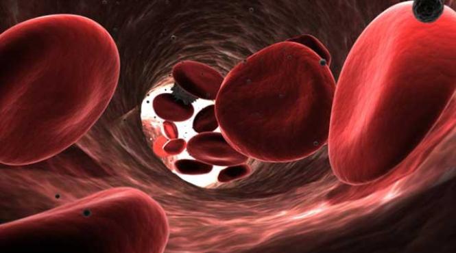 o boala a arterelor displazia fibromusculara