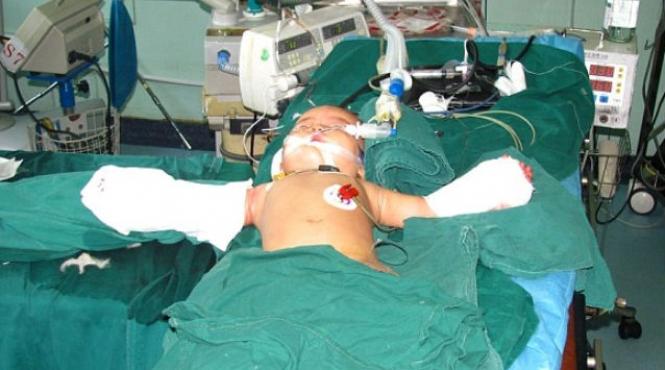 medicii se chinuie sa lipeasca bratele unui bebelus chinez in varsta de opt luni ciopartit de bunica sa