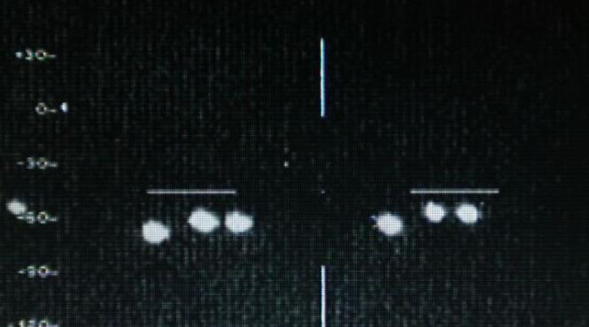 doi humanoizi fara fete au iesit si au inceput sa faca masuratori rapoarte ozn desecretizate de marea britanie