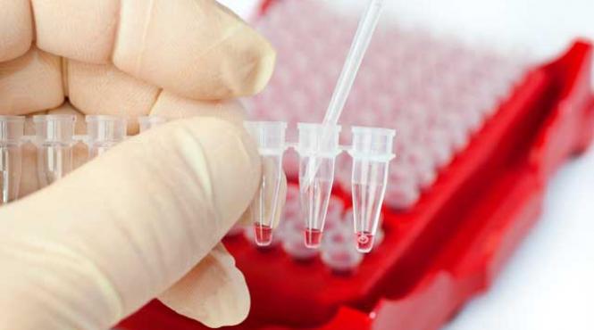 o noua boala asemanatoare cu sida depistata in asia