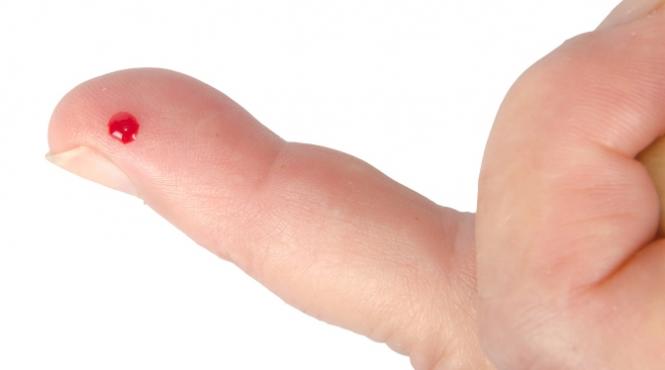 descoperire importanta in tratarea diabetului zaharat