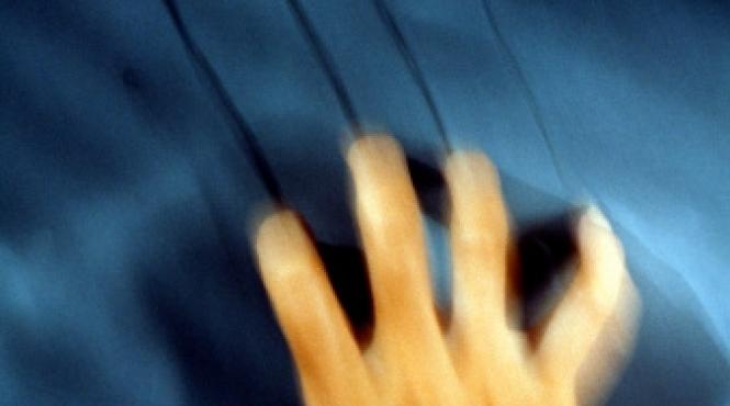 de ce ne infioara scartaitul unghiei pe tabla