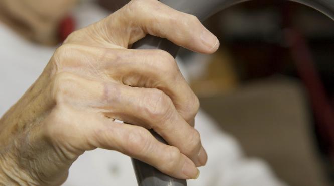 studiu boli musculo scheletice ams artrita