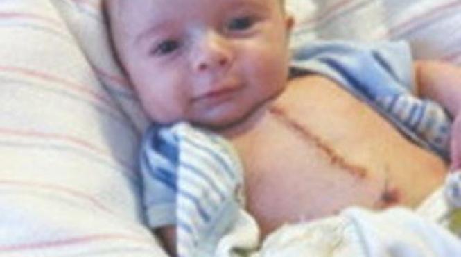 1 milion de vizualizari bebelus operat pe cord deschis