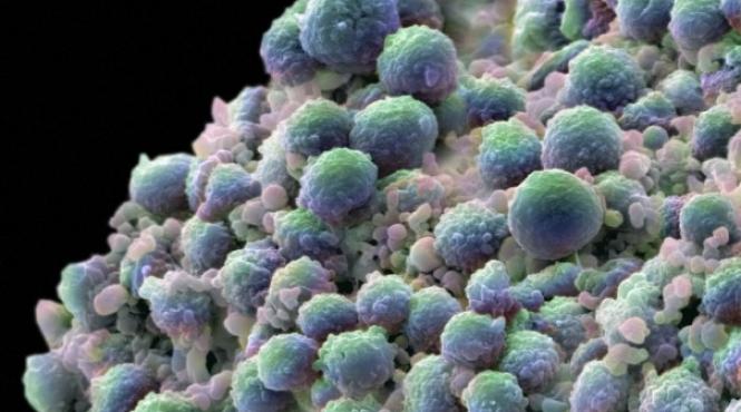 terapii ce tintesc cancerul tratamente personalizate administrate dupa scanarea genetica a tumorii