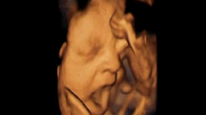imagini uluitoare un fetus casca si se freaca la ochi in pantecele mamei lui video