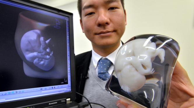 cum poti avea un model 3d al bebelusului tau nenascut