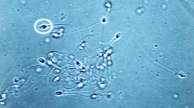 studiu scade calitatea spermei