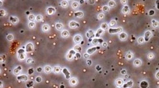 premiera mondiala in stiinta cercetatorii au creat celulele injectabile care omoara cancerul