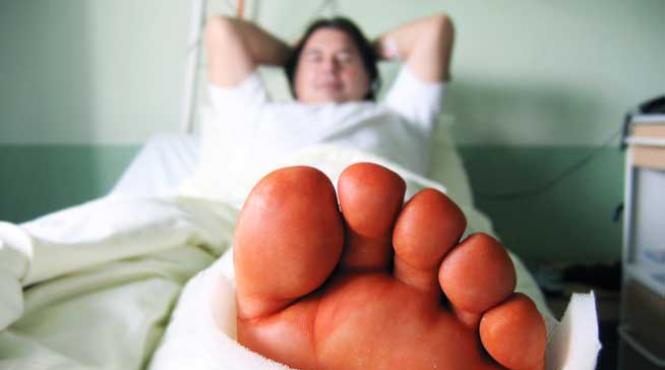 fracturi entorse luxatii a crescut numarul persoanelor aduse la spital din cauza cazaturile pe gheata