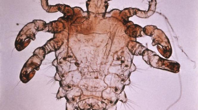 paduchi lati latei epilare