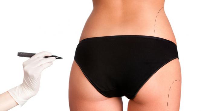 5 lucruri pe care nu le stiai despre lipoaspiratie